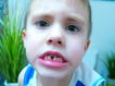 Нужно ли что-то делать, если ребенок проглотил зуб?